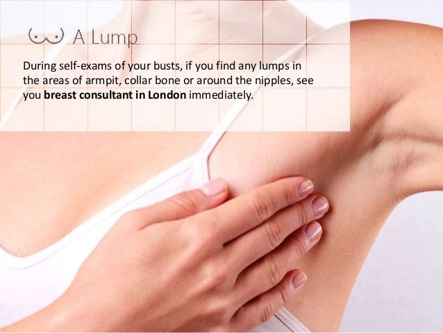 itchy nipples and breast cancer Itchy nipples and breast cancer